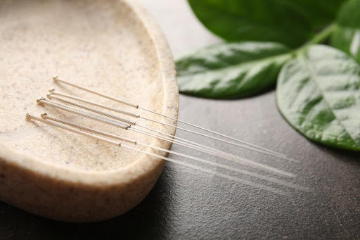 Acupuncture needles in a dish.